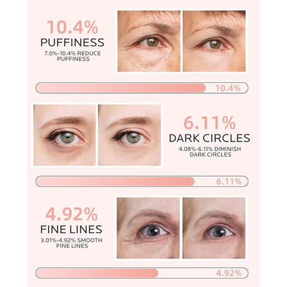 Under Eye Patches for Puffiness: Dark Circles and Puffy Eyes Treatment Caffeine Eye Mask with Niacinamide Hyaluronic Acid - Smooth Wrinkles Reduce Eye Bags Undereye Gel Pad (30 Pairs)